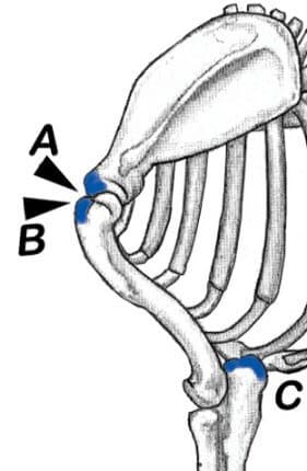 Figure 12. Location of the 'Notch' at the Junction of the Shoulder Blade and the Upper Arm. Figure 12. Location of the 'Notch' at the Junction of the Shoulder Blade and the Upper Arm.