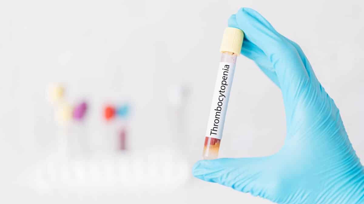 Hand holding test tube of blood with the inscription thrombocytopenia